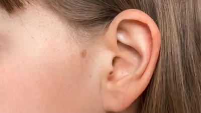 Audicien Cursus Afdrukken Maken Van Het Gezonde Volwassen Oor